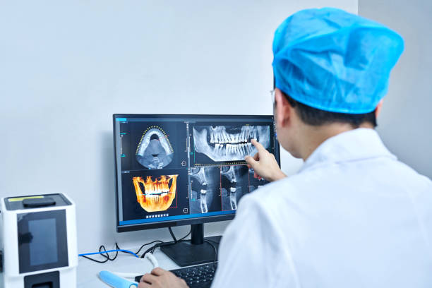 Best Emergency Root Canal Treatment in Jena, LA
