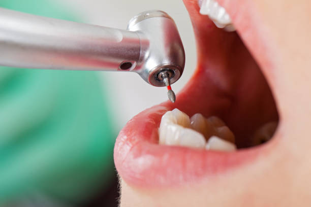 Best Pediatric Emergency Dentist in Jena, LA
